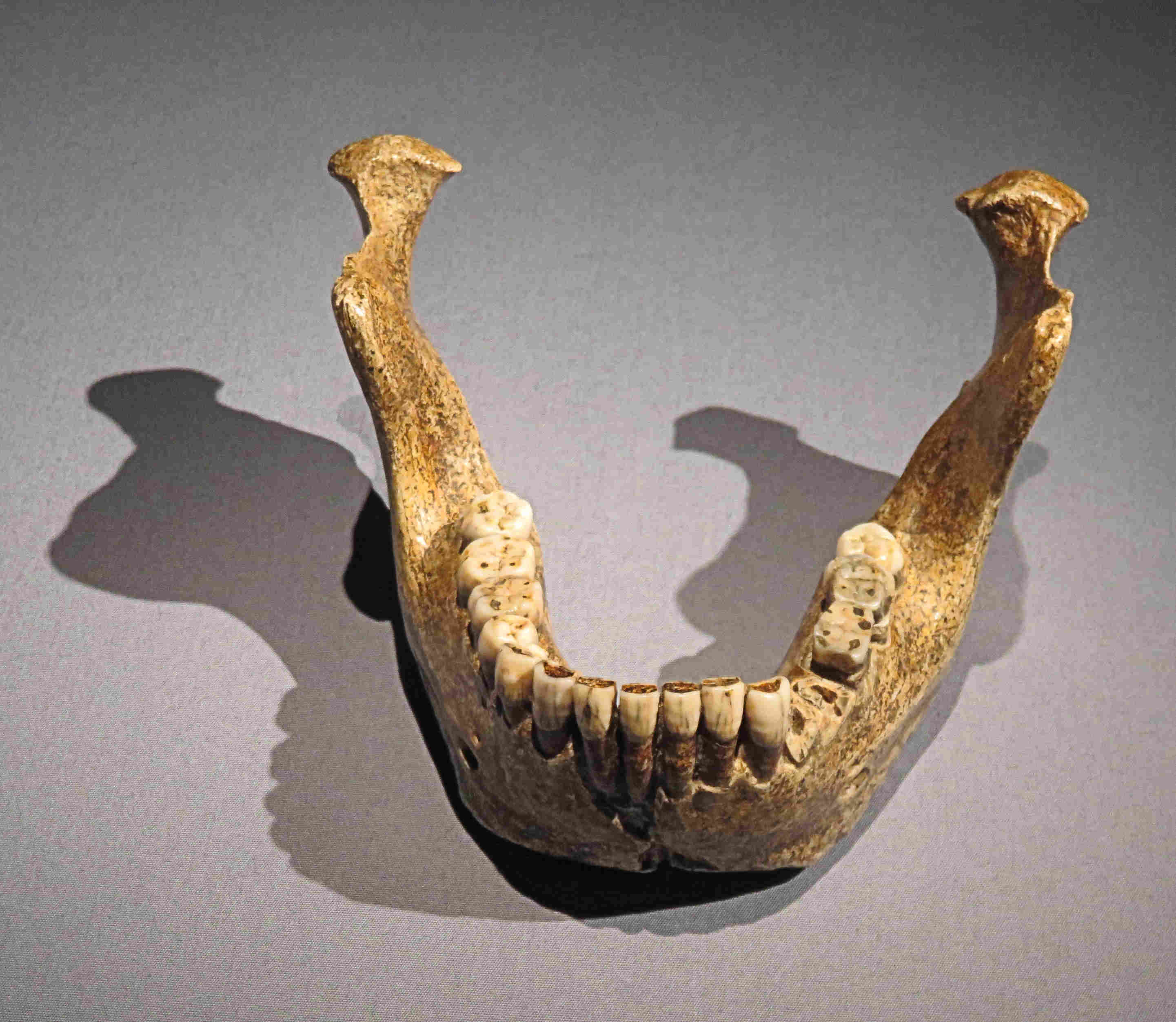 The Mauer 1 mandible, holotype of Homo heidelbergensis, a robust jawbone lacking a chin