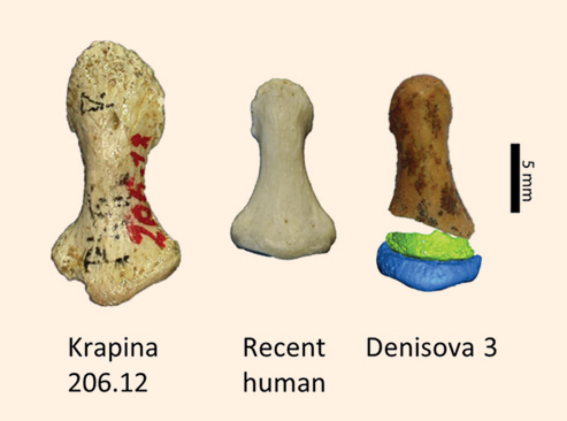 Denisova 3, a small distal finger phalanx, the first Denisovan specimen identified