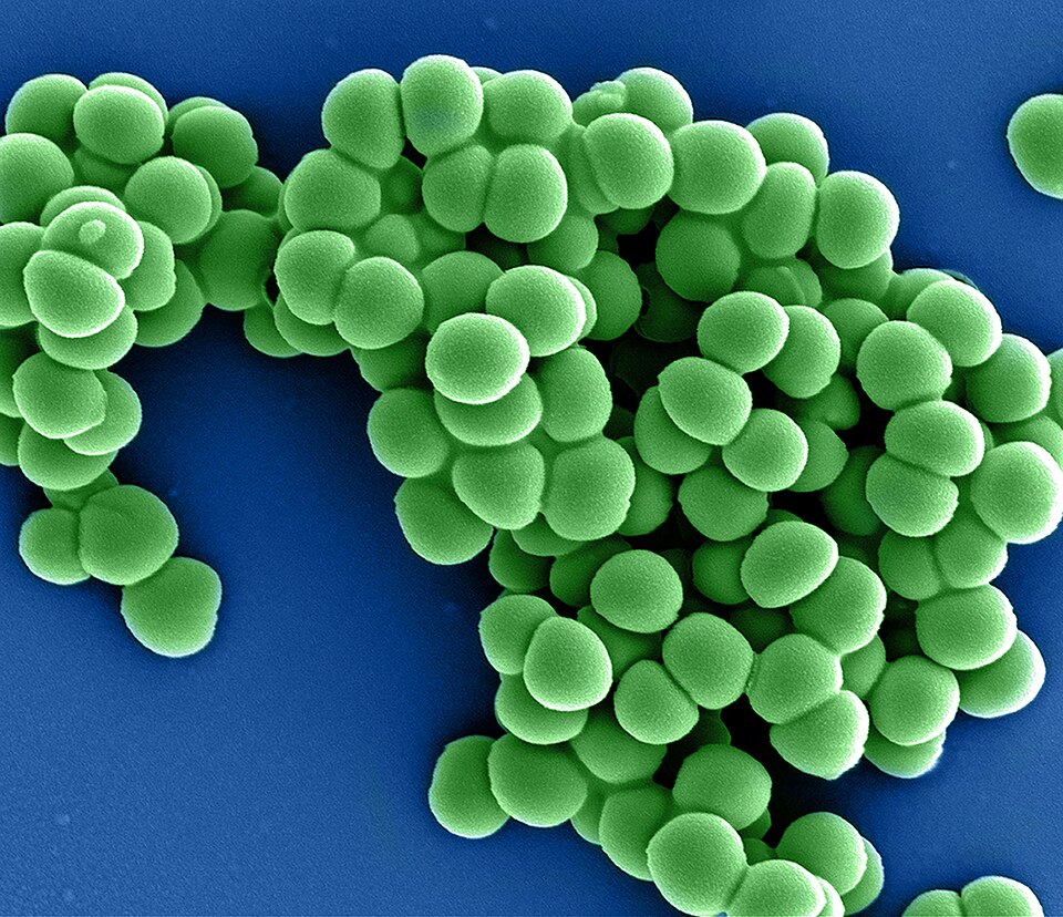 Colorized scanning electron micrograph of methicillin-resistant Staphylococcus aureus (MRSA) bacteria shown in green
