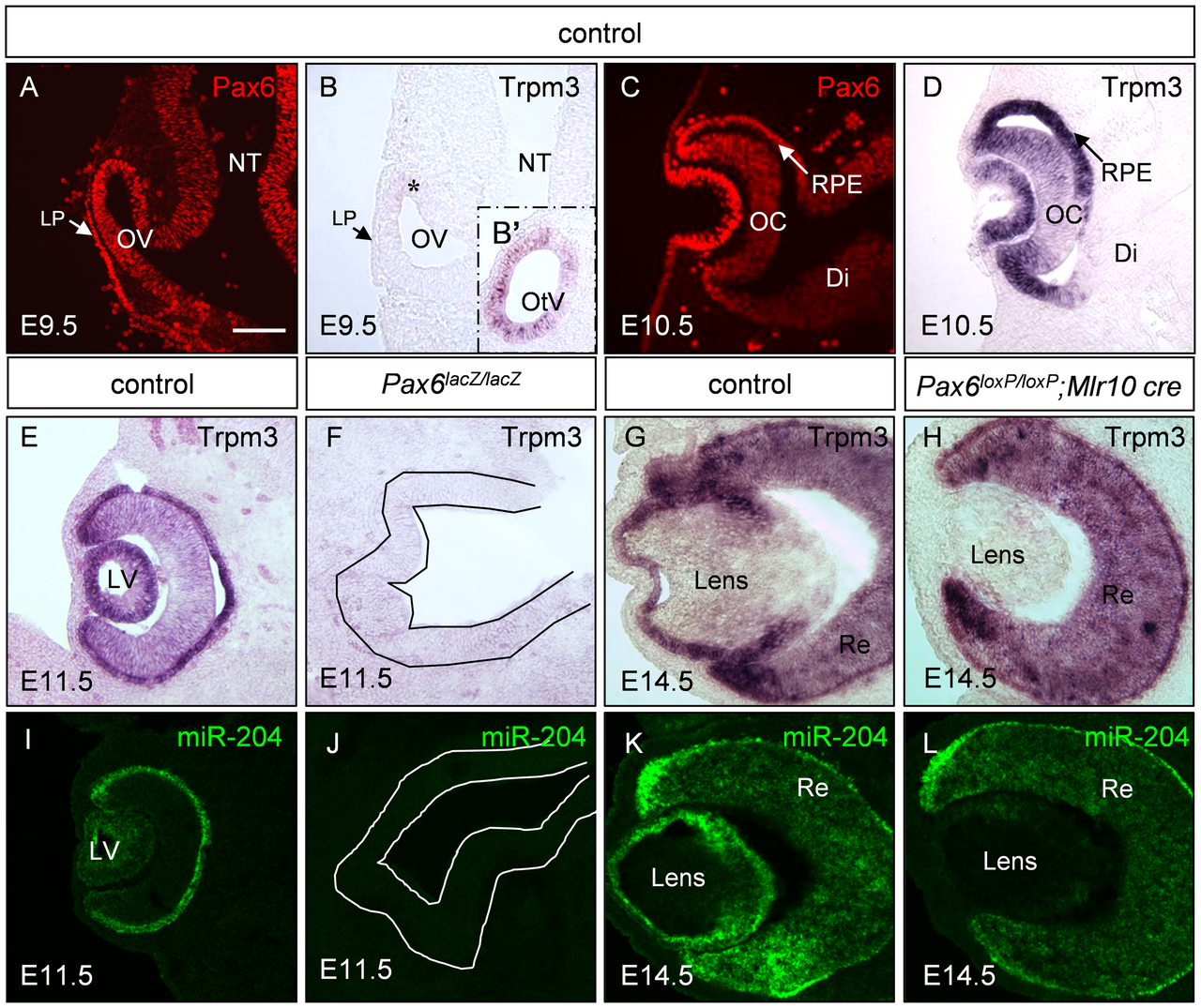 Comparison of arthropod compound eye and vertebrate camera eye structures