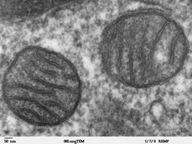 Transmission electron micrograph of mitochondria in mammalian lung tissue, showing double membrane structure