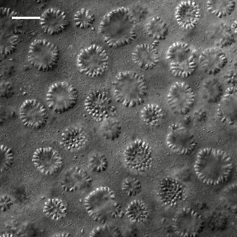 Globular colonies of the choanoflagellate Barroeca monosierra seen under a microscope