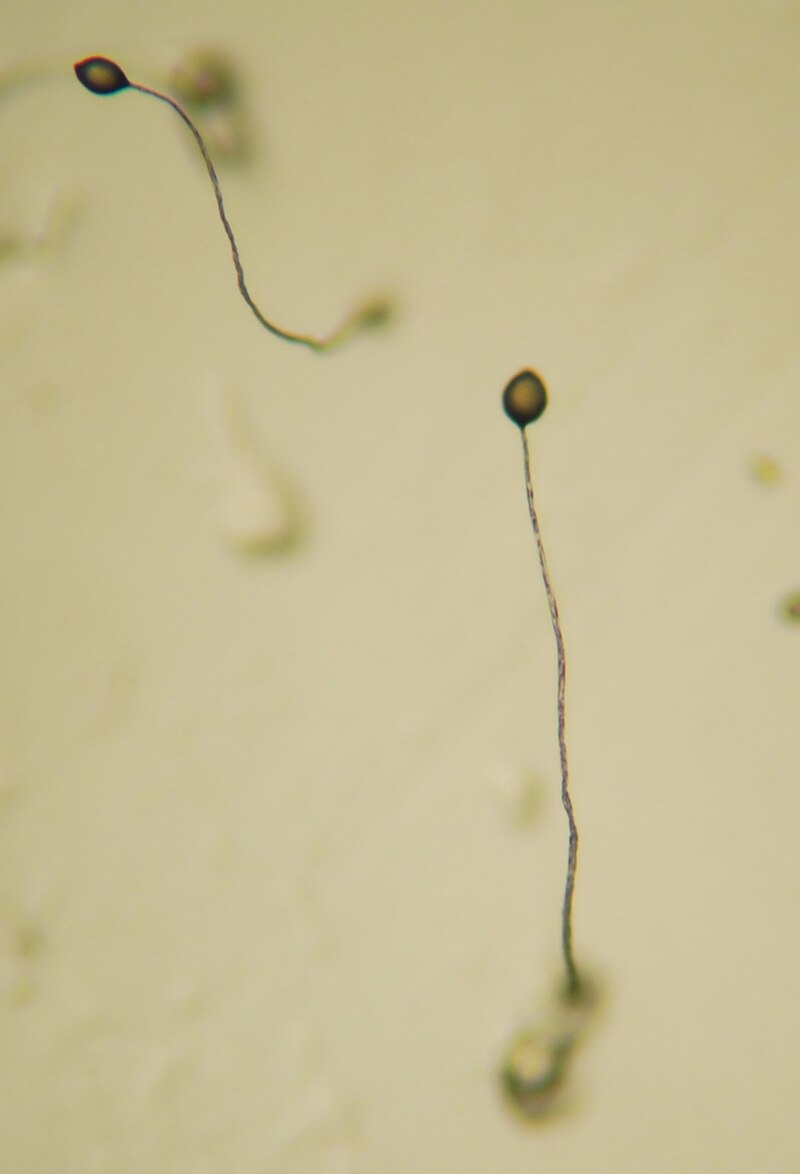 Dictyostelium discoideum fruiting bodies showing multicellular structures formed by aggregation of individual amoebae