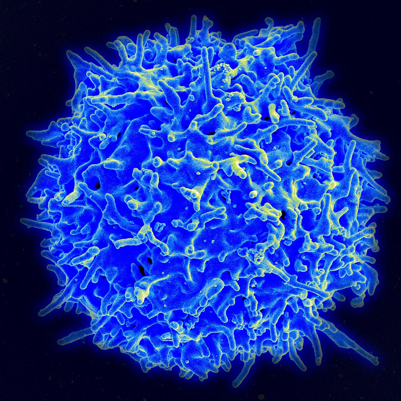 Scanning electron micrograph of a healthy human T cell, a key component of the adaptive immune system