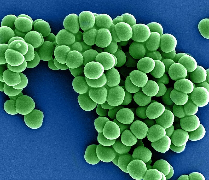 Colorized scanning electron micrograph of Methicillin-resistant Staphylococcus aureus (MRSA) bacteria