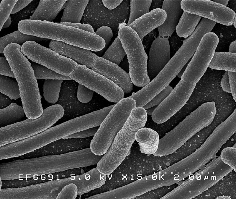 Scanning electron micrograph of rod-shaped Escherichia coli bacteria adhered to a surface