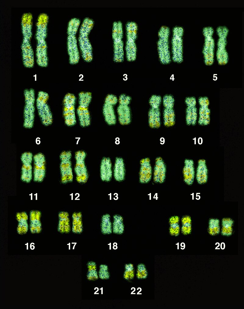 False-color fluorescence image of the full human chromosome set (23 pairs) during metaphase, stained with FISH probe showing Alu repeat sequences in green against red DNA counterstain