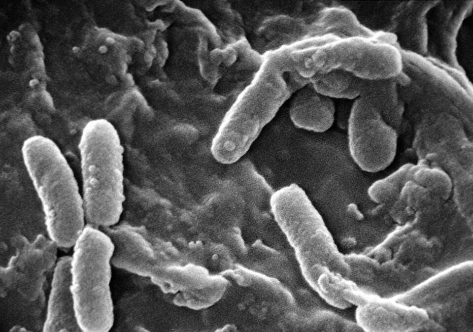 Scanning electron micrograph of Pseudomonas aeruginosa bacteria