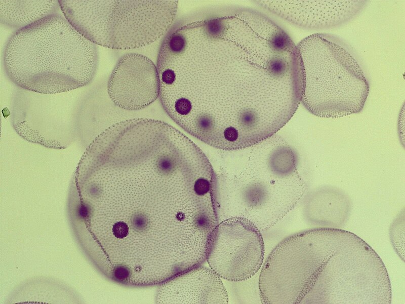 Microscope photograph of a Volvox parent colony containing multiple daughter colonies in various stages of development
