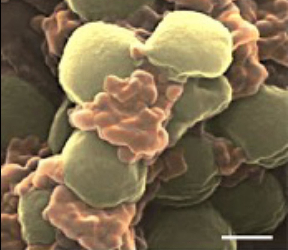Scanning electron micrograph showing MRSA252 bacteria (gold) with platelet membrane-coated nanoparticles binding to their surface
