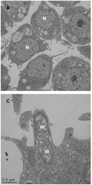 Transmission electron micrograph showing Wolbachia bacteria inside insect cells