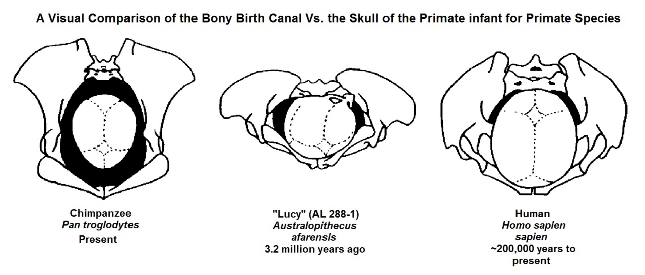 Comparison of the human birth canal and neonatal head size