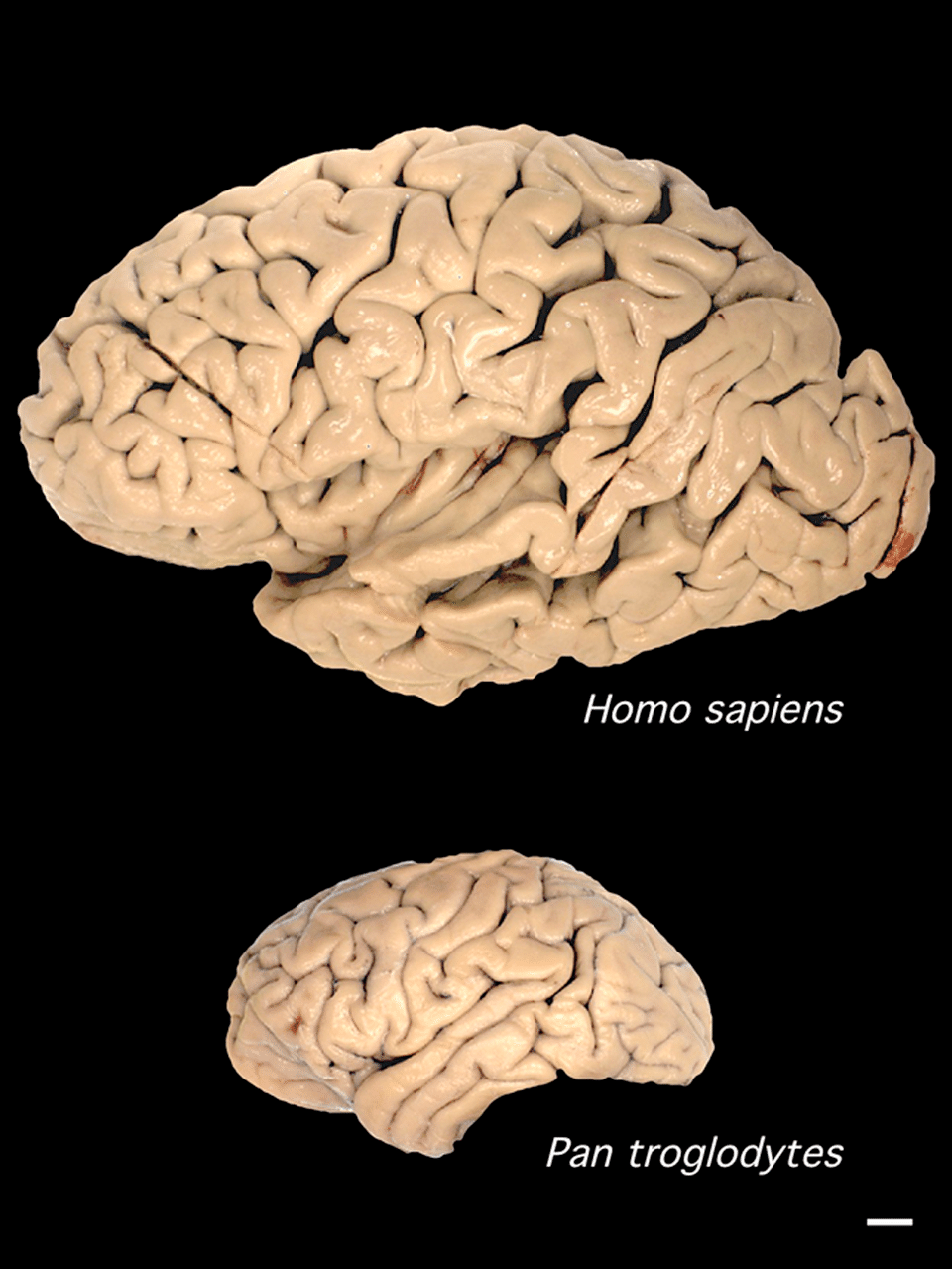 Side-by-side comparison of a human brain and a chimpanzee brain, showing the dramatic difference in size and cortical folding