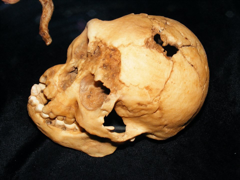 The skull of LB1, the holotype specimen of Homo floresiensis discovered in Liang Bua cave on the island of Flores, Indonesia