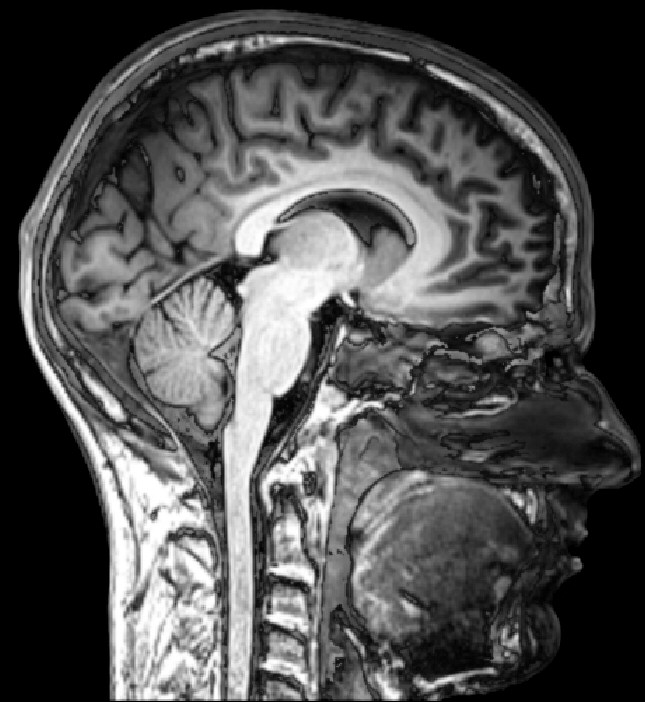Sagittal MRI scan of the human brain, whose volume has decreased over the past 30,000 years